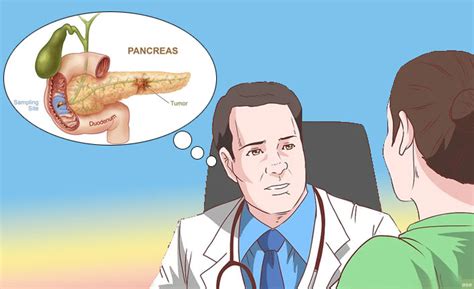 pankreas ca yaşam süresi